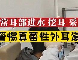 经常耳部进水 挖耳 采耳需警惕真菌性外耳道炎